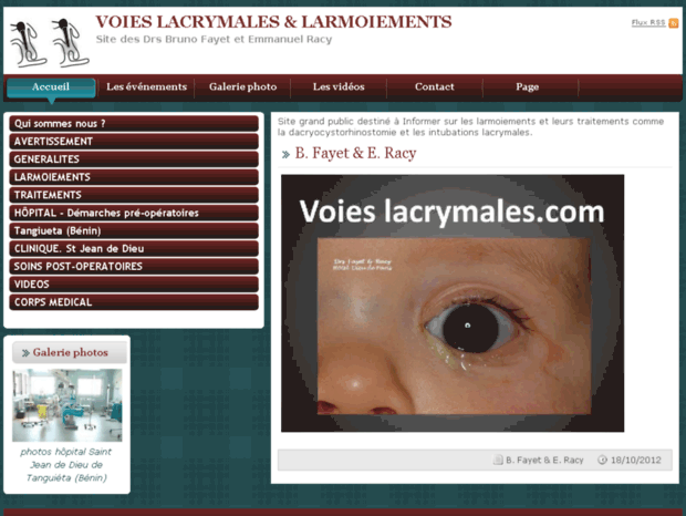voies-lacrymales.com